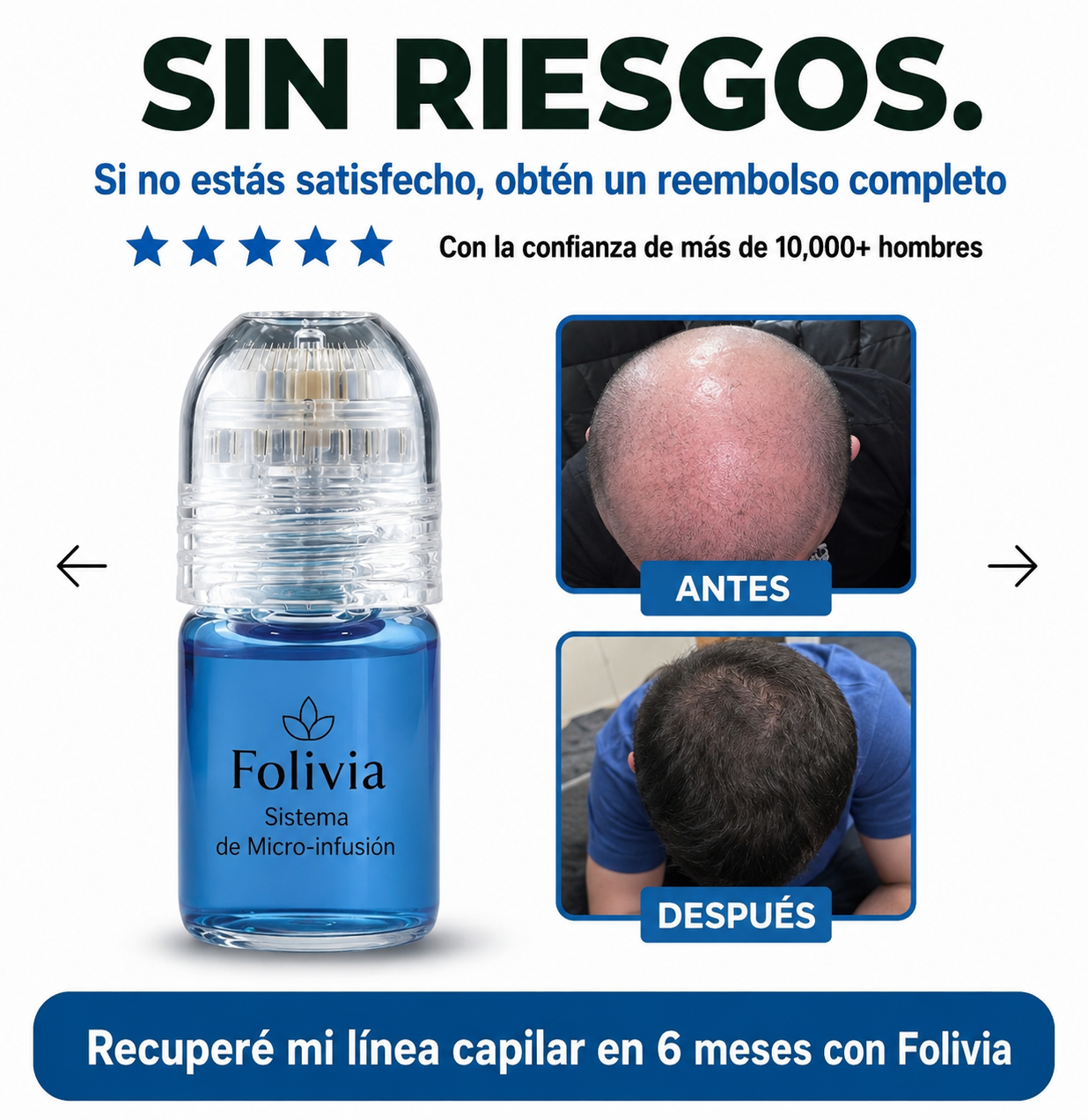 Folivia™ | Technologie de Micro-Infusion Capillaire